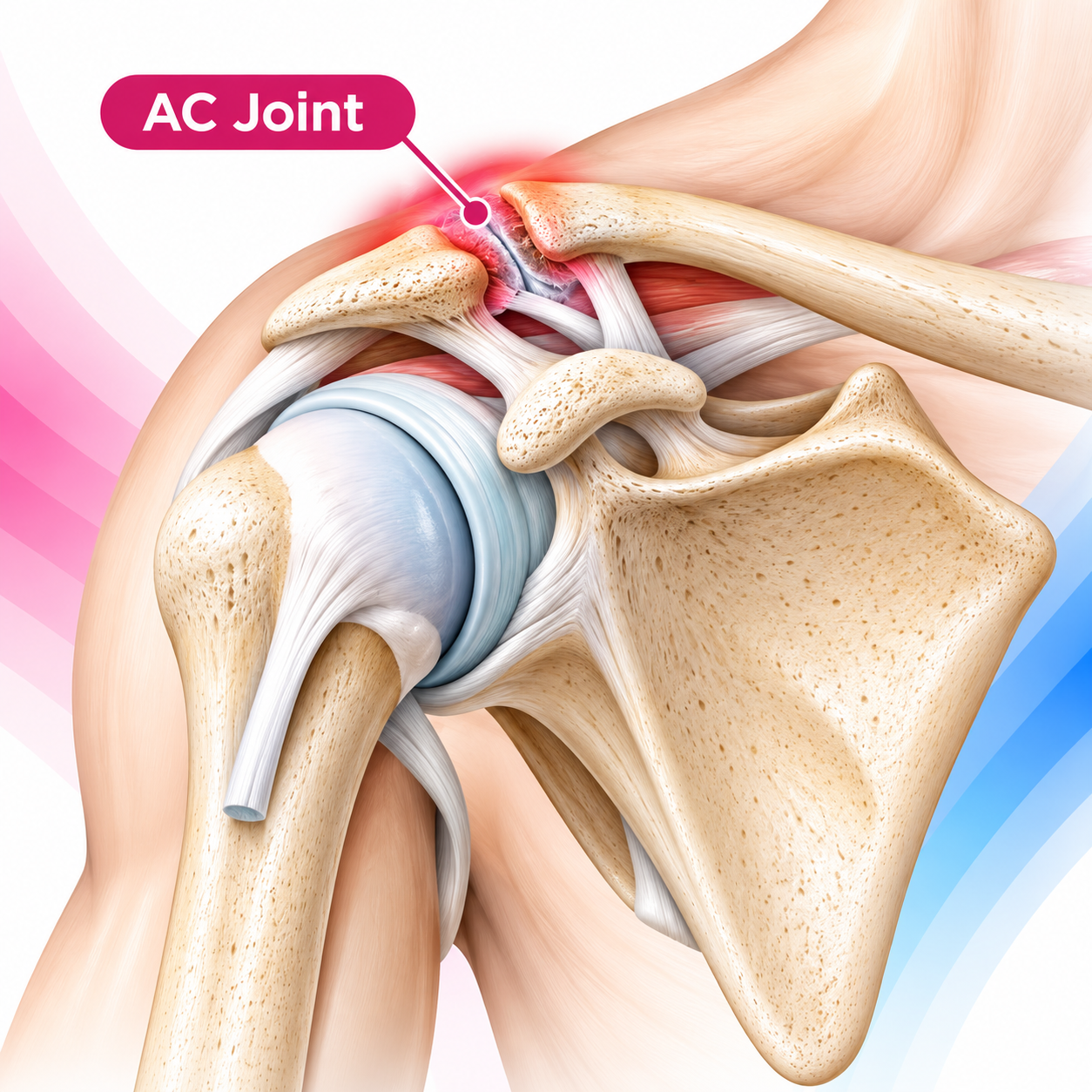 AC Joint Procedures